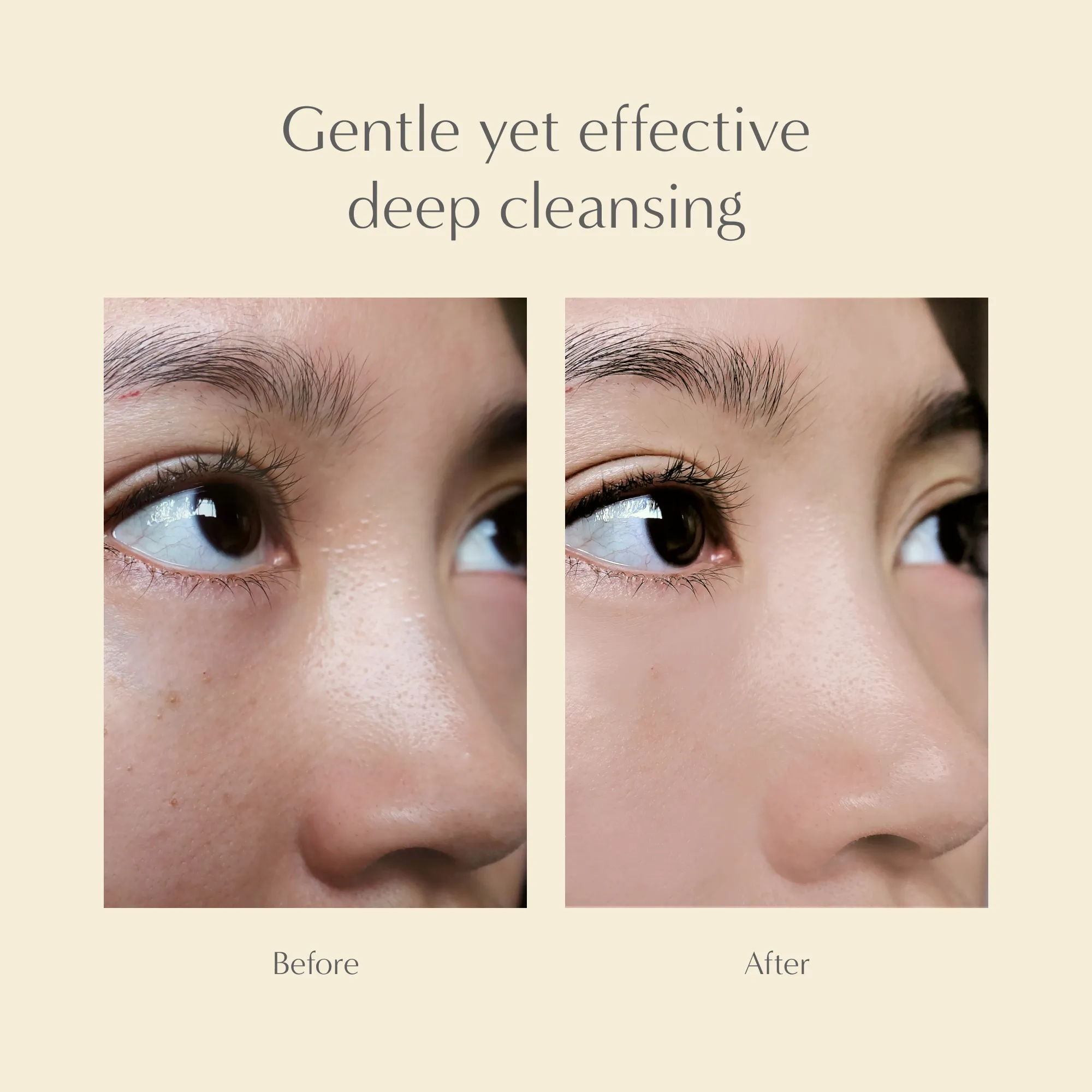 Gentle Cleansing Gel